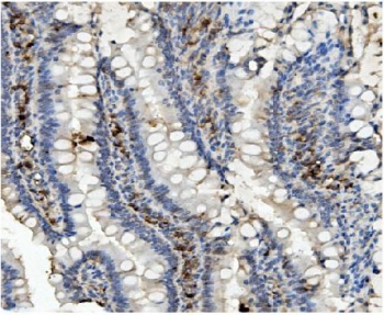 IHC staining of FFPE rat intestine with MMUT antibody. HIER: boil tissue sections in pH8 EDTA for 20 min and allow to cool before testing.