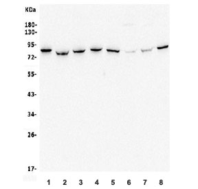 Western blot testing of human 1) HeLa, 2) K562, 3) HEK293, 4) PC-3, 5) Caco-2, 6) Raji, 7) rat PC-12 and 8) mouse NIH 3T3 lysate with MMUT antibody. Predicted molecular weight ~83 kDa.