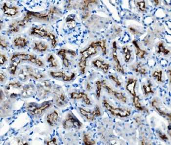 IHC staining of FFPE mouse kidney with ATG7 antibody. HIER: boil tissue sections in pH8 EDTA for 20 min and allow to cool before testing.