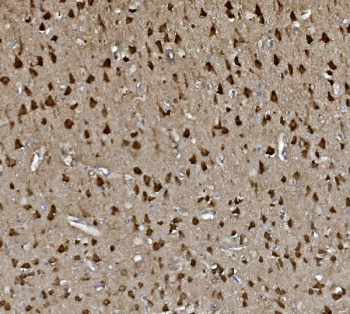 IHC staining of FFPE rat brain with GAP43 antibody. HIER: boil tissue sections in pH8 EDTA for 20 min and allow to cool before testing.