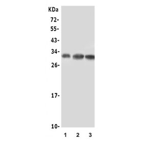Beta NGF Antibody Cell Lysate WB. Western blot analysis of human U-87 MG, 22RV1, and A549 cell lysates using recombinant rabbit monoclonal clone BDE-14. Lane 1: U-87 MG lysate, Lane 2: 22RV1 lysate, Lane 3: A549 lysate. A prominent band is detected near 27-30 kDa, consistent with the reported molecular weight range of mature beta-NGF dimer-associated forms. The observed signal pattern aligns with processed Nerve growth factor expression and neurotrophin-associated signaling biology across multiple human cell types.