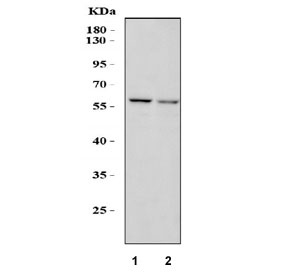 Western blot testing of 1) rat liver and 2) mouse liver lysate with SMAD5 antibody. Expected molecular weight: 52~60 kDa.
