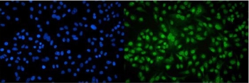 AHR Antibody A549 Cells IF. Immunofluorescent staining of FFPE human A549 cells demonstrates AHR expression using an AHR antibody (green). AHR, also known as Aryl Hydrocarbon Receptor and an Environmental Sensor Protein, is a ligand activated transcription factor that mediates cellular responses to xenobiotics, endogenous metabolites, and inflammatory signals. Prominent nuclear and perinuclear fluorescence is observed, consistent with the activation and nuclear translocation of AHR required for transcriptional regulation. DAPI nuclear stain identifies cell nuclei (blue). Heat induced epitope retrieval was performed by steaming sections in pH 6 citrate buffer for 20 minutes prior to staining. These results support the utility of AHR Antibody for studies of toxicology, signal transduction, immune regulation, and cancer biology.