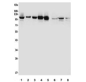 AHR Antibody Human Mouse Rat WB. Western blot analysis of AHR expression using an AHR antibody. Lane 1: human A549 cell lysate. Lane 2: human HeLa cell lysate. Lane 3: human PC-3 cell lysate. Lane 4: human U-87 MG cell lysate. Lane 5: human Caco-2 cell lysate. Lane 6: rat kidney tissue lysate. Lane 7: mouse heart tissue lysate. Lane 8: mouse NIH 3T3 cell lysate. AHR, also known as Aryl Hydrocarbon Receptor and an Environmental Sensor Protein, is a ligand activated transcription factor that regulates xenobiotic metabolism and cellular responses to environmental and endogenous signals. A distinct band is detected at approximately 95 kDa in all samples, corresponding to the expected molecular weight of full length AHR. Variations in signal intensity reflect differential expression among tissues and cell types. These results demonstrate conserved AHR expression across human, rat, and mouse samples and support the utility of AHR Antibody for studies of toxicology, signal transduction, and environmental sensing.