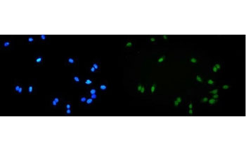 Immunofluorescent staining of FFPE human U-2 OS cells with ALKBH1 antibody (green) and DAPI nuclear stain (blue). HIER: steam section in pH6 citrate buffer for 20 min.