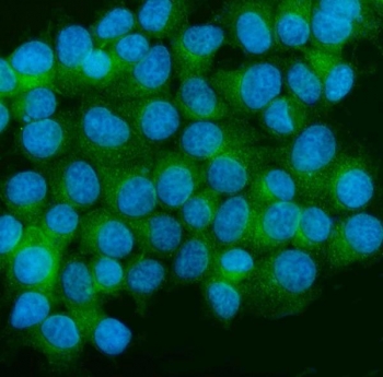 CAMK II alpha Antibody MCF7 Cell IF. Immunofluorescent staining of MCF7 cells with CAMK II alpha antibody (green). Heat-induced epitope retrieval (HIER) was performed by steaming sections in pH 6 citrate buffer for 20 minutes prior to staining. Nuclei are counterstained with DAPI (blue). CAMK II alpha immunoreactivity is observed predominantly within the cytoplasm, consistent with the expected localization of Calcium/Calmodulin Dependent Protein Kinase II Alpha (CAMK2A), a calcium signaling kinase that regulates calcium-dependent signal transduction, protein phosphorylation, and intracellular signaling pathways.