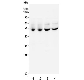 CAMK II alpha Antibody Rat and Mouse Brain WB. Western blot testing of different lots of 1-2) rat brain and 3-4) mouse brain tissue lysates with CAMK II alpha antibody. A prominent immunoreactive band is detected at approximately 54 kDa in all lysates, consistent with the predicted molecular weight of Calcium/Calmodulin Dependent Protein Kinase II Alpha (CAMK2A). An additional band at approximately 65 kDa is consistently observed and likely represents a phosphorylated or other post-translationally modified form of this calcium signaling kinase, which plays essential roles in synaptic plasticity, learning, memory, and neuronal signal transduction.