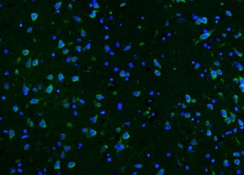 CAMK II alpha Antibody Rat Brain IF. Immunofluorescent staining of FFPE rat brain tissue with CAMK II alpha antibody (green). Heat-induced epitope retrieval (HIER) was performed by steaming sections in pH 8 EDTA buffer for 20 minutes prior to staining. Nuclei are counterstained with DAPI (blue). CAMK II alpha immunoreactivity is observed in neuronal cell bodies and processes, consistent with the expected distribution of Calcium/Calmodulin Dependent Protein Kinase II Alpha (CAMK2A), a calcium signaling kinase that regulates synaptic plasticity, protein phosphorylation, learning, memory, and neuronal signal transduction.