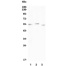 Western blot testing of 1) rat spleen, 2) mouse thymus and 3) mouse NIH 3T3 lysate with CCNB1 antibody. Expected molecular weight: 48-60 kDa.