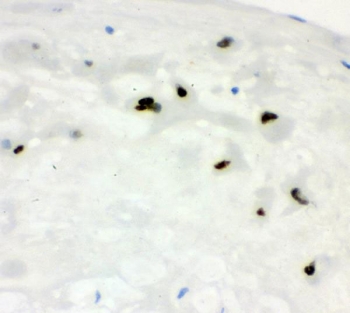 CCNE1 Antibody Placenta IHC. Immunohistochemistry staining of FFPE human placenta with CCNE1 antibody. HIER: boil tissue sections in pH8 EDTA for 20 min and allow to cool before testing.