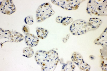 CCNE1 Antibody Placental Tissue IHC. Immunohistochemistry staining of FFPE human placenta with CCNE1 antibody. HIER: boil tissue sections in pH8 EDTA for 20 min and allow to cool before testing.