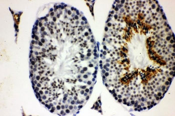 CCNE1 Antibody Mouse Testis IHC. Immunohistochemistry staining of FFPE mouse testis with CCNE1 antibody. HIER: boil tissue sections in pH8 EDTA for 20 min and allow to cool before testing.