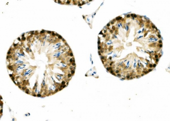 IHC staining of FFPE mouse testis with DNAJA2 antibody. HIER: boil tissue sections in pH8 EDTA for 20 min and allow to cool before testing.