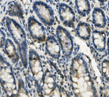 Gastrotropin Antibody Rat Intestine IHC. Immunohistochemical staining of FFPE rat intestine demonstrates Gastrotropin expression using a Gastrotropin antibody. Gastrotropin, also known as Intestinal Lipid Binding Protein and FABP6, is an intracellular Bile Acid Binding Protein that facilitates bile acid recycling and supports lipid absorption in enterocytes. Distinct apical and cytoplasmic staining is observed in intestinal epithelial cells, consistent with the known localization of FABP6 in tissues involved in enterohepatic circulation. Heat induced epitope retrieval was performed by boiling tissue sections in pH 8 EDTA buffer for 20 minutes followed by cooling prior to staining. These results support the utility of Gastrotropin Antibody for studies of nutrient absorption, bile acid metabolism, and gastrointestinal physiology.