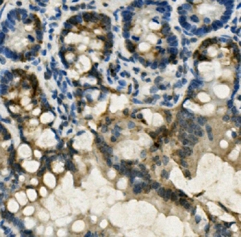 Gastrotropin Antibody Rat Intestinal Epithelium IHC. Immunohistochemical staining of FFPE rat intestine reveals Gastrotropin expression using a Gastrotropin antibody. Gastrotropin, also known as Intestinal Lipid Binding Protein and FABP6, is an intracellular Bile Acid Binding Protein that mediates the transport of bile acids and hydrophobic metabolites within enterocytes. Prominent cytoplasmic staining is observed in absorptive epithelial cells lining the intestinal glands, with particularly strong reactivity in cells adjacent to mucin containing goblet cells. Heat induced epitope retrieval was performed by boiling tissue sections in pH 8 EDTA buffer for 20 minutes followed by cooling prior to staining. These findings support the utility of Gastrotropin Antibody for studies of bile acid homeostasis, intestinal lipid handling, and digestive physiology.