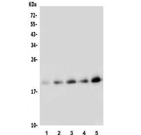 Western blot testing of 1) rat ovary, 2) mouse lung, 3) mouse ovary, 4) mouse kidney and 5) mouse NIH 3T3 lysate with FGF10 antibody. Predicted molecular weight ~23 kDa.