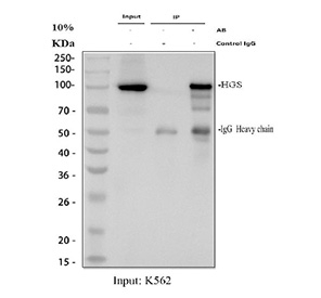 Immunoprecipitation of HGS protein from 500ug of human K562 whole cell lysate with 2ug of HGS antibody.