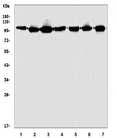 Western blot testing of human 1) HeLa, 2) HEK293, 3) K562, 4) SK-O-V3, 5) PC-3, 6) A549 and 7) HepG2 cell lysate with HGS antibody. Predicted molecular weight ~86 kDa, commonly observed at 110-115 kDa.