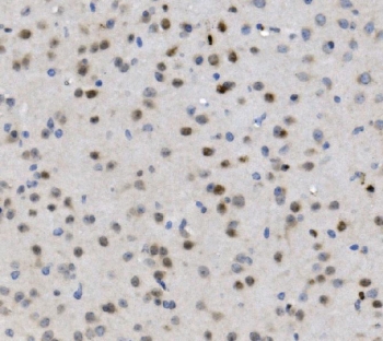 IHC staining of FFPE mouse brain with MBD4 antibody. HIER: boil tissue sections in pH8 EDTA for 20 min and allow to cool before testing.