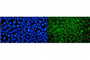 Immunofluorescent staining of FFPE human A431 cells with MED4 antibody (green) and DAPI nuclear stain (blue). HIER: steam section in pH6 citrate buffer for 20 min.