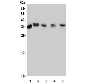 Western blot testing of human 1) U-2 OS, 2) A549, 3) K562, 4) rat brain and 5) mouse RAW264.7 lysate with MED4 antibody. Predicted molecular weight ~30 kDa, commonly observed at 30-36 kDa.