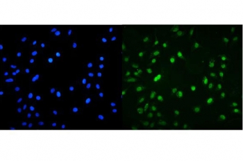 Immunofluorescent staining of FFPE human A549 cells with MNT antibody (green) and DAPI nuclear stain (blue). HIER: steam section in pH6 citrate buffer for 20 min.