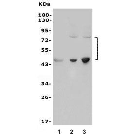 Western blot testing of 1) rat brain, 2) human SW620 and 3) human Caco-2 lysate with NGF Receptor antibody. Predicted molecular weight ~45/75 kDa (unmodified/glycosylated).