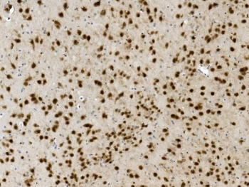 IHC staining of FFPE mouse brain with NOVA2 antibody. HIER: boil tissue sections in pH8 EDTA for 20 min and allow to cool before testing.