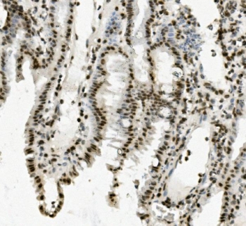 IHC staining of FFPE mouse intestine with PRDM5 antibody. HIER: boil tissue sections in pH8 EDTA for 20 min and allow to cool before testing.