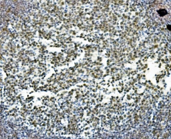 IHC staining of FFPE rat intestine with PRDM5 antibody. HIER: boil tissue sections in pH8 EDTA for 20 min and allow to cool before testing.