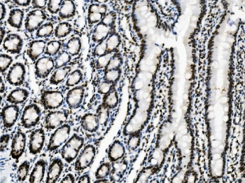 IHC staining of FFPE rat intestine with Vinexin antibody. HIER: boil tissue sections in pH8 EDTA for 20 min and allow to cool before testing.