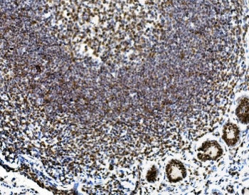 IHC staining of FFPE rat intestine with Vinexin antibody. HIER: boil tissue sections in pH8 EDTA for 20 min and allow to cool before testing.