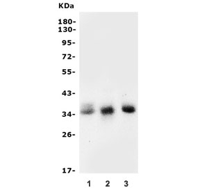Western blot testing of 1) human PC-3, 2) rat brain and 3) mouse brain lysate with SPRY2 antibody. Expected molecular weight: 35-39 kDa, may be observed as a doublet.