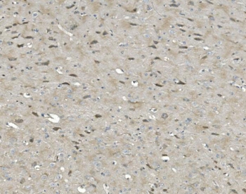IHC staining of FFPE rat brain with ULK1 antibody. HIER: boil tissue sections in pH8 EDTA for 20 min and allow to cool before testing.