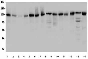 Western blot testing of 1) human HEK293, 2) human placenta, 3) monkey liver, 4) monkey kidney, 5) human PC-3, 6) human HeLa, 7) human A549, 8) rat kidney, 9) rat liver, 10) rat lung, 11) rat PC-12, 12) mouse lung, 13) mouse RAW264.7 and 14) mouse NIH 3T3 lysate with USP25 antibody. Predicted molecular weight ~122 kDa. 