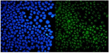 Immunofluorescent staining of FFPE human A431 cells with USP44 antibody (green) and DAPI nuclear stain (blue). HIER: steam section in pH6 citrate buffer for 20 min.