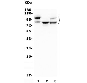 Western blot testing of human 1) A549, 2) HEK293 and 3) PC-3 lysate with Glucosidase Alpha Acid antibody. Expected molecular weight ~110 kDa (precursor), ~95 kDa (intermediate), ~76 and 70 kDa (lysosomal forms).