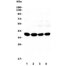 Synaptophysin Antibody for Mouse/Rat WB. Western blot analysis of rat brain lysate (lanes 1-2) and mouse brain lysate (lanes 3-4) shows a strong band at approximately 34-38 kDa, consistent with the predicted molecular weight of Synaptophysin (SYP). Synaptophysin is an integral synaptic vesicle membrane glycoprotein that is highly enriched in presynaptic terminals of neurons, and strong expression in brain tissue is expected due to the high density of synaptic vesicles within neuronal neuropil. The Synaptophysin antibody detects SYP protein in rodent neuronal tissue by western blot.