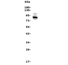 Western blot testing of rat brain lysate with Adam28 antibody. Predicted molecular weight ~87 kDa.