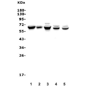 Western blot testing of human 1) SW620, 2) A549, 3) K562, 4) rat brain and 5) mouse spleen lysate with ANGPT2 antibody. Expected molecular weight: 57-70 kDa depending on glycosylation level.