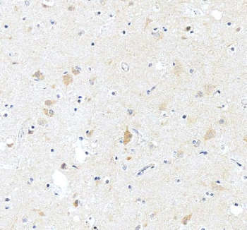 IHC staining of FFPE human brain tissue with ASIC2 antibody, HRP-secondary and DAB substrate. HIER: boil tissue sections in pH8 EDTA for 20 min and allow to cool before testing.