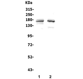 Western blot testing of human 1) COLO-320 and 2) Jurkat lysate with ASXL1 antibody. Predicted molecular weight ~165 kDa.