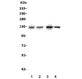 Western blot testing of human 1) HEK293, 2) K562, 3) PC-3 and 4) HeLa lysate with ATP11C antibody. Predicted molecular weight ~129 kDa.