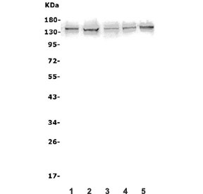 Western blot testing of human 1) A431, 2) U-2 OS, 3) U-87 MG, 4) PC-3 and 5) K562 lysate with AXL antibody. Expected molecular weight: 104-140 kDa depending on glycosylation level.