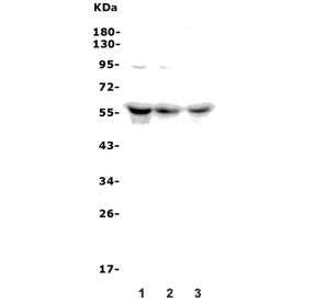 Western blot testing of 1) human Caco-2, 2) rat PC-12 and 3) mouse NIH 3T3 lysate with PCTAIRE1 antibody. Predicted molecular weight ~56 kDa.