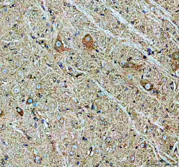 IHC staining of FFPE rat spinal cord with Chat antibody. HIER: boil tissue sections in pH8 EDTA for 20 min and allow to cool before testing.