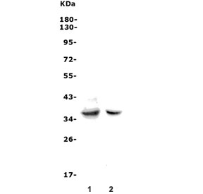 Fas Antibody WB. Western blot testing of 1) rat thymus and 2) mouse RAW264.7 cell lysate with Fas antibody. Predicted molecular weight: 35-38 kDa (unmodified), 40-55 kDa (glycosylated).