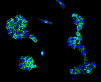 MC4-R Antibody A431 Cell IF. Immunofluorescent staining of FFPE human A431 cells using MC4-R antibody demonstrates prominent cytoplasmic and membranous staining (green), consistent with expression of Melanocortin Receptor 4 (MC4-R). MC4-R is a G protein-coupled receptor that mediates melanocortin-dependent signaling pathways involved in energy homeostasis, appetite regulation, neuroendocrine communication, and metabolic control. The observed staining pattern is consistent with the expected localization of a membrane-associated receptor and supports the utility of MC4-R antibody for studies of melanocortin receptor biology and hormone-mediated signaling pathways. DAPI nuclear stain (blue) identifies cell nuclei and provides contrast to the predominantly cytoplasmic and cell surface-associated distribution of MC4-R. HIER: steam section in pH6 citrate buffer for 20 min.