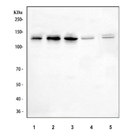 Western blot testing of 1) human Caco-2, 2) human HeLa, 3) human SH-SY5Y, 4) rat brain and 5) mouse brain tissue lysate with OFD1 antibody. Predicted molecular weight ~117 kDa.