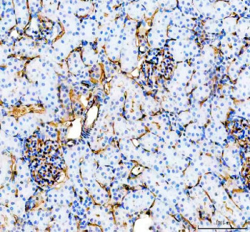 IHC staining of FFPE rat kidney tissue with Cd31 antibody, HRP-secondary and DAB substrate. HIER: boil tissue sections in pH8 EDTA for 20 min and allow to cool before testing.